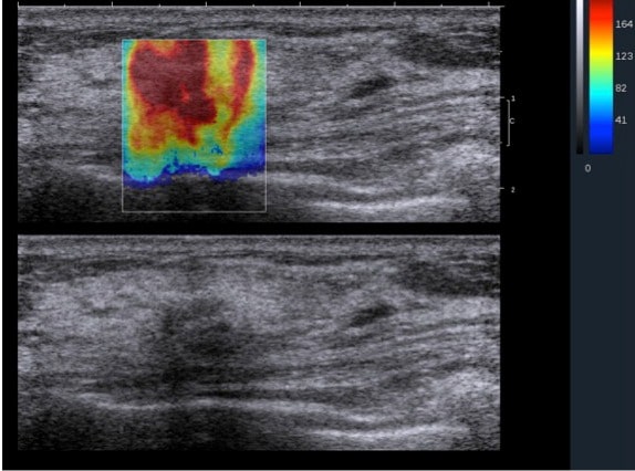 الاستوگرافی