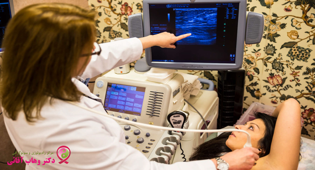 سونوی پستان