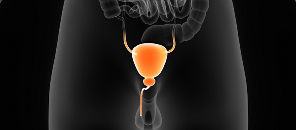 تغییر شکل مثانه