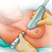 نمونه بردای پستان