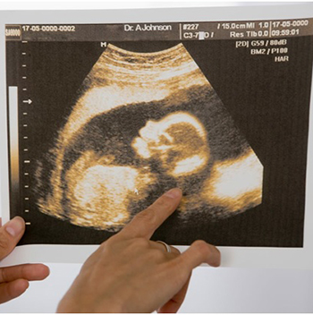 سونوگرافی بارداری