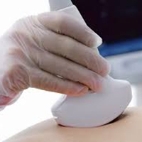 سونوگرافی پروپ