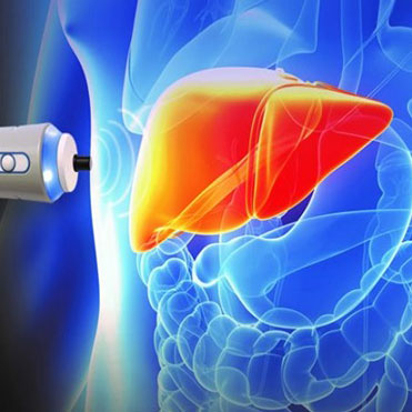 الاستوگرافی کبد چه کاربردی دارد
