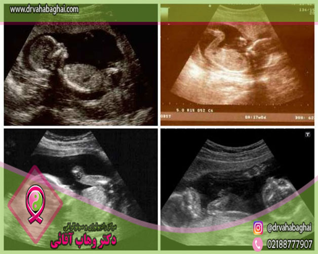 تفسیر آنلاین سونوگرافی بارداری