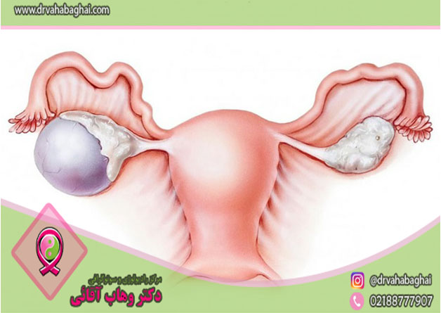 کیست در موئید چیست