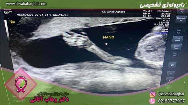 رادیولوژی تشخیصی