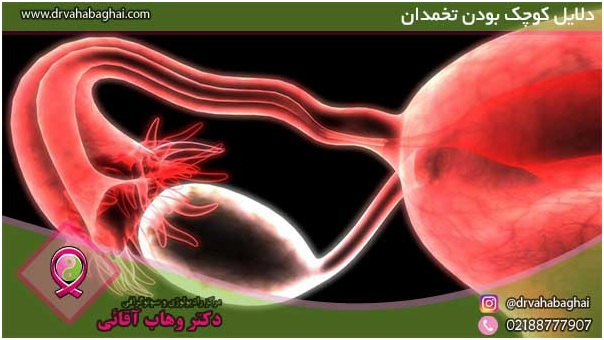 علائم کوچک بودن تخمدان
