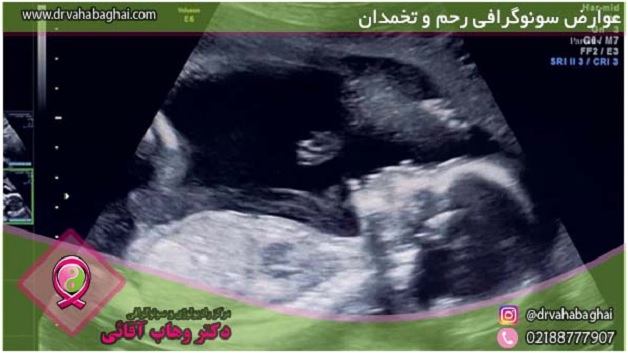 بهترین زمان برای سونوگرافی رحم و تخمدان