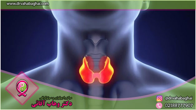 ندول سرد غده تیروئید