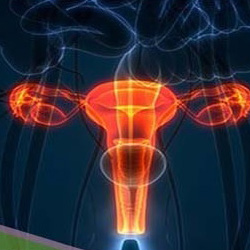 علت عفونت رحم