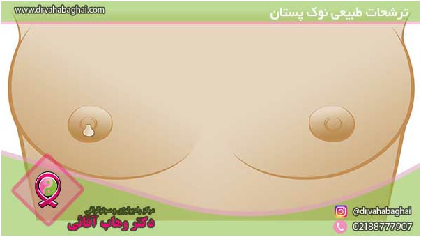 انواع ترشح پستان