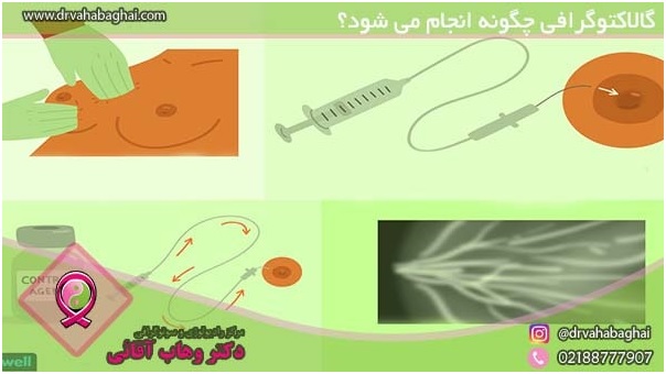 گالاکتوگرافی چگونه انجام میشود