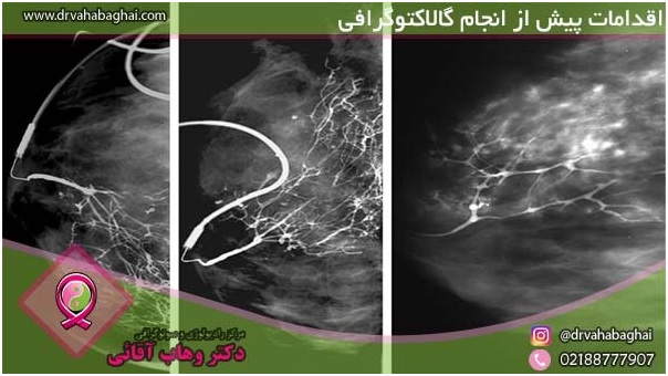 اقدامات پیش از گالاکتوگرافی
