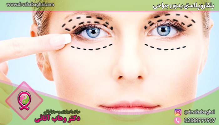 بلفاروپلاستی بدون جراحی