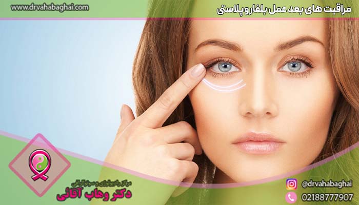 مراقبت های بعد از عمل بلفاروپلاستی