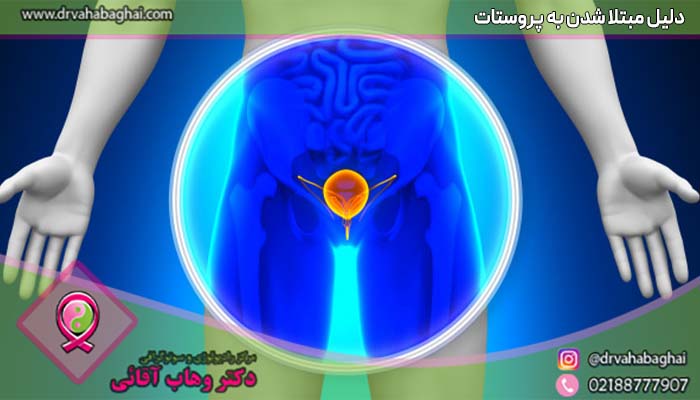 دلیل مبتلاشدن به پروستات