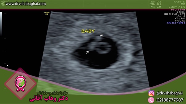 بهترین رادیولوژی برای انجام سونوگرافی شکمی