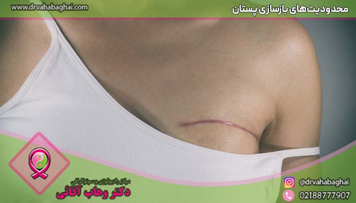 محدودیت های بازسازی پستان