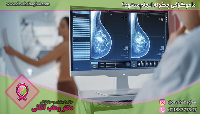 ماموگرافی چگونه انجام می شود