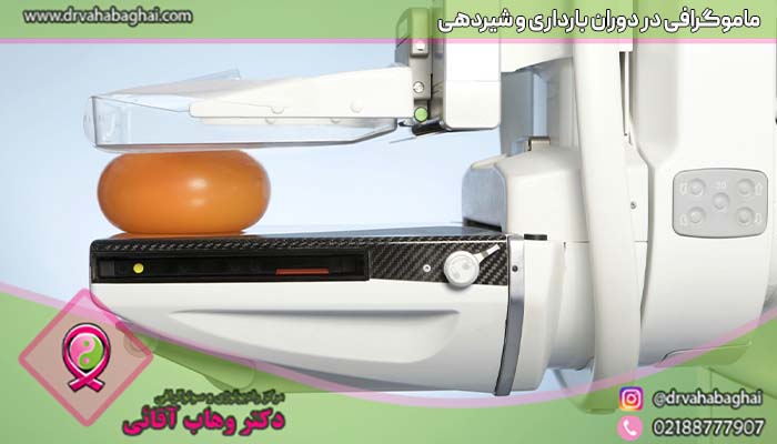 ماموگرافی در دوران شیردهی و بارداری