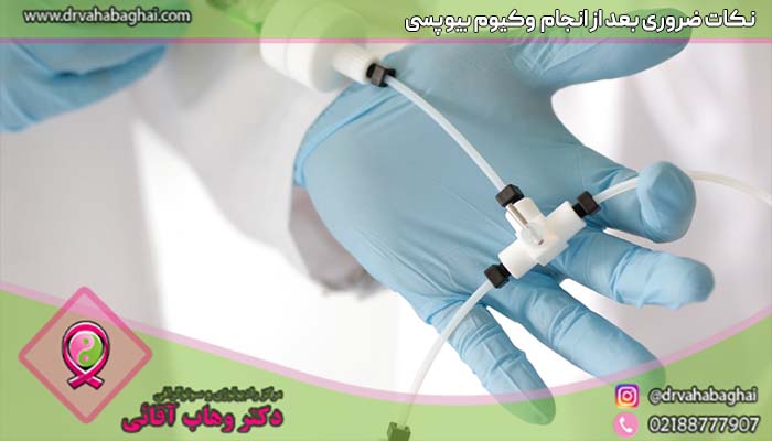 نکات ضروری بعد از انجام وکیوم بیوپسی