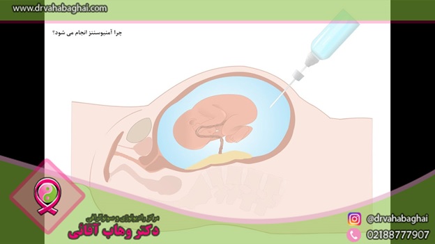 چرا آمنیوسنتز انجام می شود؟