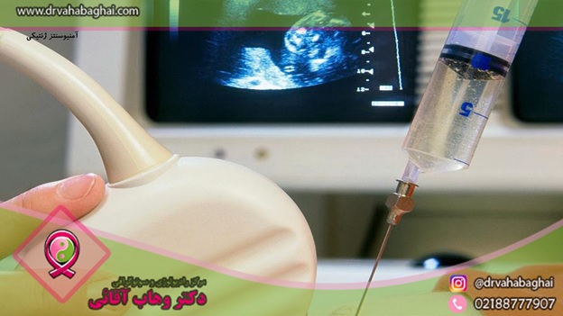 آمنیوسنتز ژنتیکی