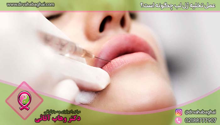 چگونگی عمل تخلیه ژل