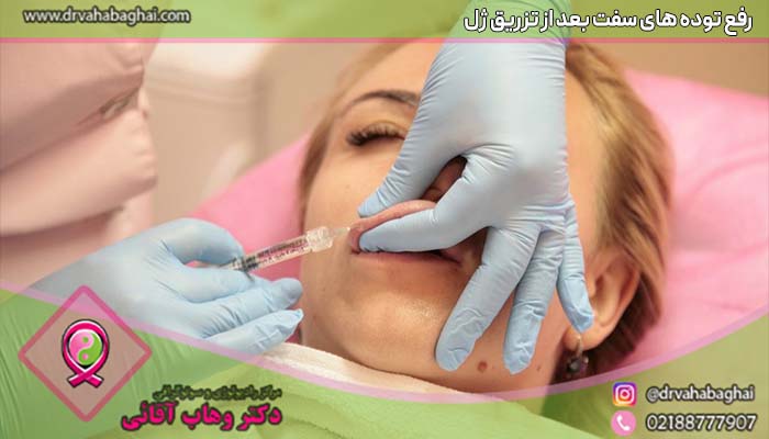 رفع توده های سفت بعد از تزریق ژل