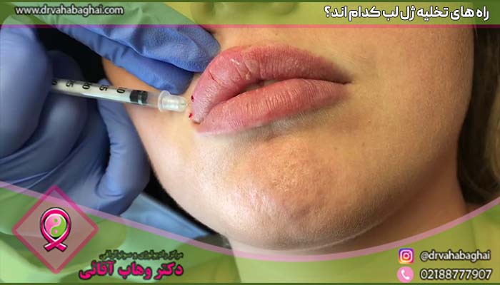 راه های تخلیه ژل