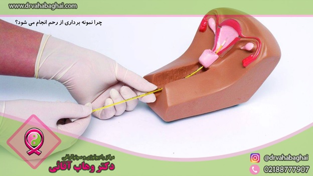 چرا نمونه برداری از رحم انجام می شود؟