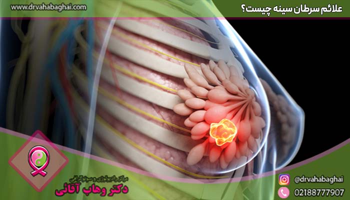 علائم سرطان سینه