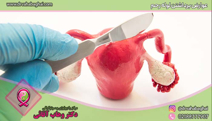 عوارض برداشتن لوله رحم