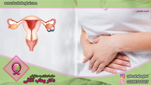 کیست تخمدان