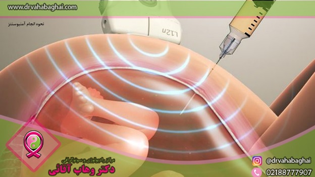 نحوه ازمایش امینوسنتز