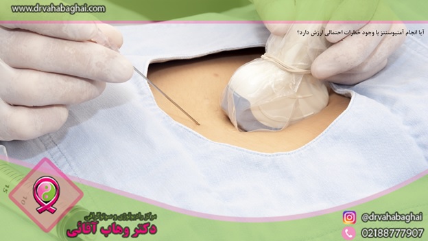 ارزش انجام آمینوسنتز