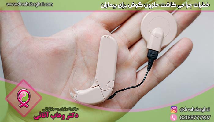 خطرات کاشت حلزون گوش