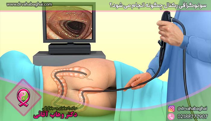 سونوگرافی رکتال چگونه انجام می شود؟