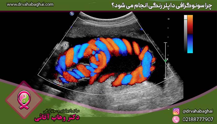 چرا سونوگرافی داپلر رنگی انجام می شود؟