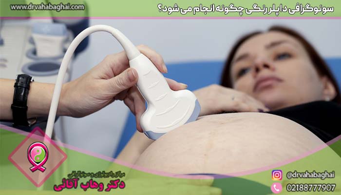 چگونگب انجام سونوگرافی داپلر رنگی