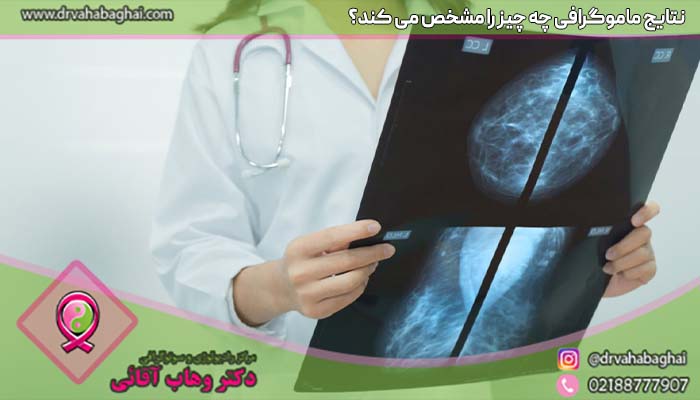 نتایج ماموگرافی