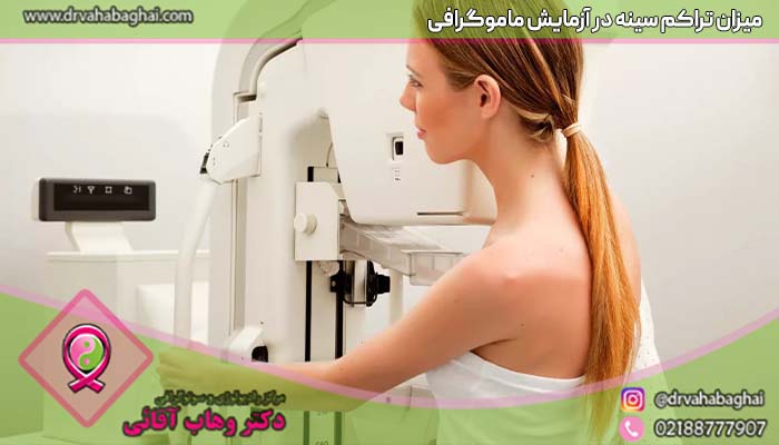 میزان تراکم سینه در ماموگرافی
