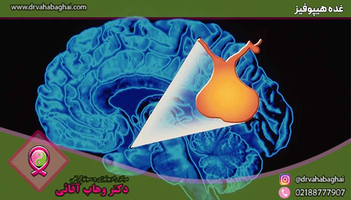 غده هیپوفیز