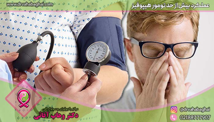 عملکرد بیش از حد غده هیپوفیز