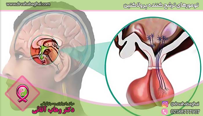 هورمون های ترشح کننده پرولاکتین