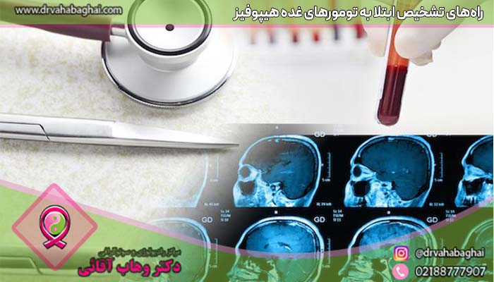 تشخیص غده هیپوفیز