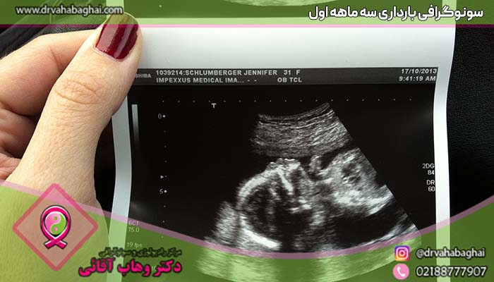 سونوگرافی بارداری سه ماهه اول