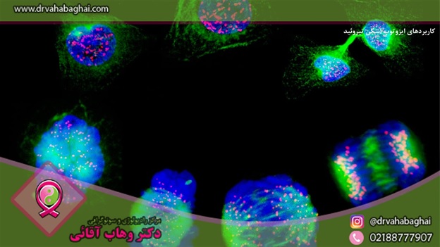 کاربردهای اسکن تیروئید