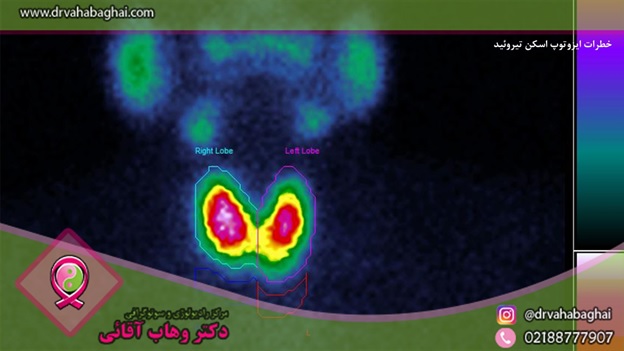 خطرات اسکن تیروئید