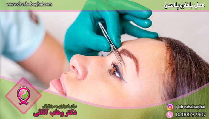 عمل بلفاروپلاستی